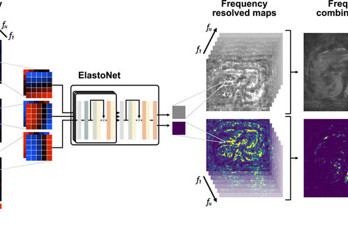 Das Bild zeigt eine schematische Darstellung des ElastoNet-Systems zur Analyse von multifrequenziellen Wellenfeldern. Links befinden sich Diagramme mit Wellenverschiebungen, während rechts Frequenzkarten angezeigt werden. Es gibt separate Bereiche für Scherwellen und Unsicherheitskarten, um verschiedene Aspekte der Daten zu visualisieren.
