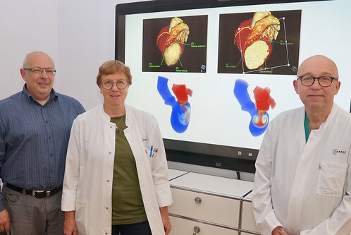 Drei Personen stehen vor einem großen Bildschirm, der medizinische Bilder eines Herzens zeigt. Eine Person trägt einen weißen Kittel, die anderen sind in zivil gekleidet. Die Bilder verdeutlichen möglicherweise eine medizinische Analyse oder Präsentation.