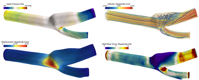 Die Abbildung zeigt Simulationsergebnisse in vier Bereichen: statischer Druck, Geschwindigkeits- und Verschiebungsgradienten sowie Wand-Scherviskosität. Jedes Feld wird durch Farbverläufe illustriert, die die jeweiligen Werte veranschaulichen und unterschiedliche physikalische Phänomene in einem Fluiddynamik-Kontext darstellen.