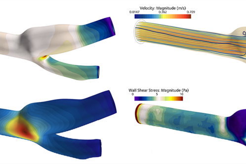 Die Abbildung zeigt Simulationsergebnisse in vier Bereichen: statischer Druck, Geschwindigkeits- und Verschiebungsgradienten sowie Wand-Scherviskosität. Jedes Feld wird durch Farbverläufe illustriert, die die jeweiligen Werte veranschaulichen und unterschiedliche physikalische Phänomene in einem Fluiddynamik-Kontext darstellen.