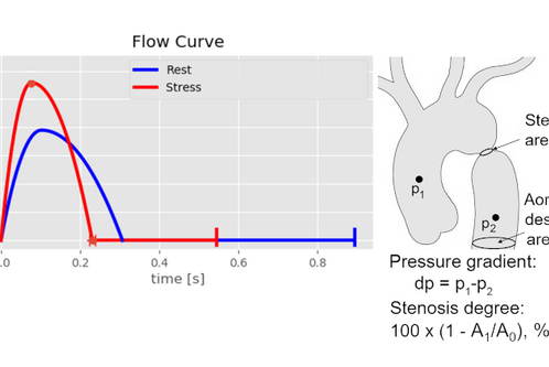 Die Abbildung zeigt eine Flusskurve mit zwei Linien: blau für Ruhe und rot für Stress, die den Fluss über die Zeit darstellen. Rechts sind anatomische Diagramme mit Druckpunkten und einer Stenose beschrieben. Die Formeln erläutern den Druckgradienten und den Grad der Stenose.
