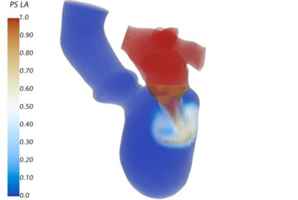 Das Bild zeigt eine dreidimensionale Darstellung des menschlichen Herzens, farblich codiert, um unterschiedliche Druckwerte anzuzeigen. Rottöne repräsentieren hohe Werte, während Blautöne niedrigere Werte darstellen. Eine Farblegende auf der linken Seite verdeutlicht die Skala.
