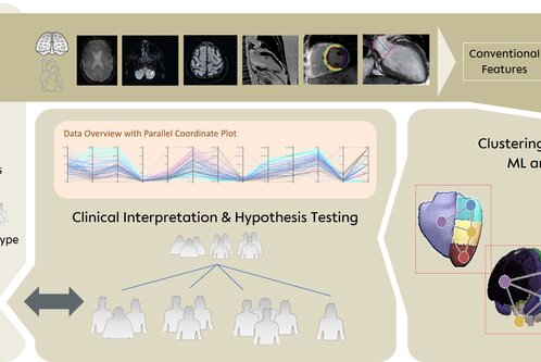 Die Grafik zeigt den Forschungsprozess im Projekt BeLOVE, der bildgebende Verfahren, klinische Interpretation und Hypothesentests umfasst. Außerdem sind Methoden zur Clusterung und Klassifizierung mithilfe maschinellen Lernens dargestellt, um klinische Ergebnisse zu analysieren und zu interpretieren.