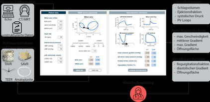 Diagramm zur klinischen Beurteilung von Herzpatienten. Enthält patientenbezogene Daten, TEER-Geräteplatzierung und hämodynamische Parameter wie Schlagvolumen, Ejektionsfraktion und Druckverläufe. Verbindet verschiedene diagnostische Verfahren wie Echo und MRT, um Behandlungsoptionen zu evaluieren.