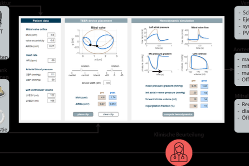 Diagramm zur klinischen Beurteilung von Herzpatienten. Enthält patientenbezogene Daten, TEER-Geräteplatzierung und hämodynamische Parameter wie Schlagvolumen, Ejektionsfraktion und Druckverläufe. Verbindet verschiedene diagnostische Verfahren wie Echo und MRT, um Behandlungsoptionen zu evaluieren.