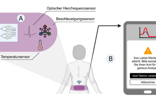 Das Bild zeigt ein medizinisches System zur Überwachung von Laktatwerten. Es umfasst Sensoren zur Herzfrequenz und Temperatur sowie eine Datenübertragungseinheit. Ein Smartphone zeigt eine Warnmeldung über erhöhte Laktatwerte und fordert den Benutzer auf, einen Arzttermin zu vereinbaren.