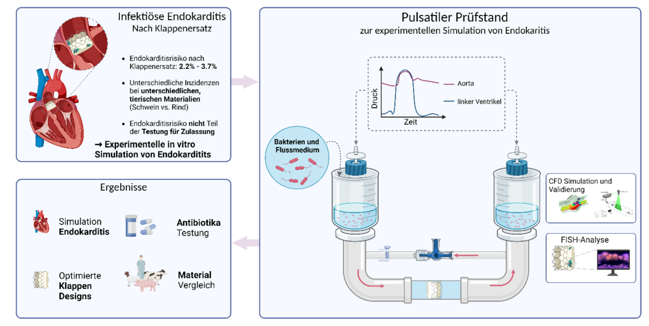 Dieses Bild zeigt eine grafische Darstellung eines Prüfstands zur Simulation von infektiöser Endokarditis. Oben links werden Unterschiede bei Endokarditis erwähnt, während rechts der Pulsatiler Prüfstand und die Untersuchung von Bakterien und Flussdynamik zu sehen sind. Ergebnisse umfassen Simulation, Antibiotika-Tests und optimierte Klappendesigns.