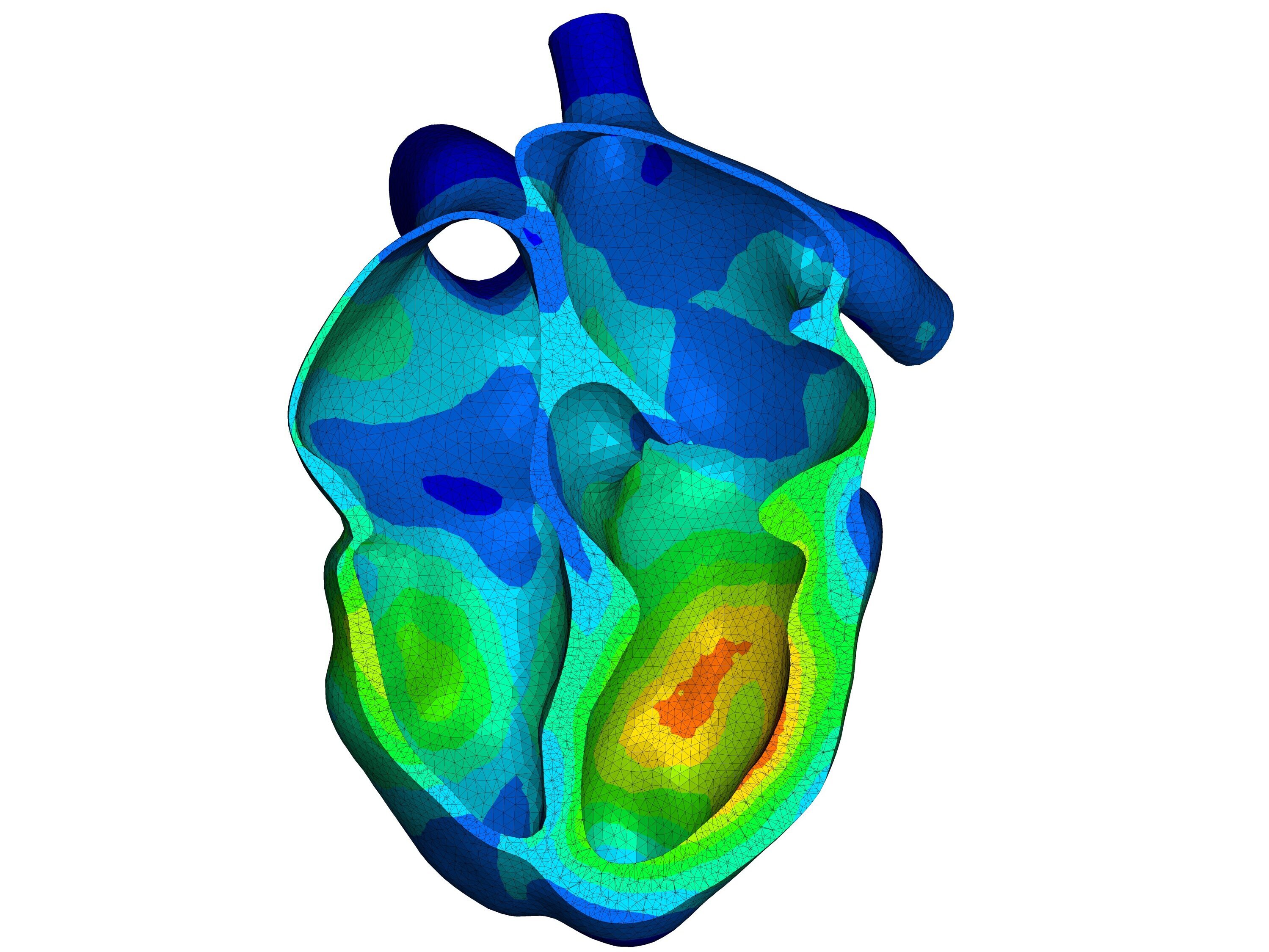 Eine dreidimensionale Darstellung eines Herzens, hervorgehoben durch unterschiedliche Farben, die verschiedene Bereiche und möglicherweise deren Funktion oder Zustand darstellen. Die Farben reichen von Blau über Grün bis Gelb und Rot, was auf verschiedene Temperaturen oder Aktivitäten im Herzgewebe hinweisen könnte.