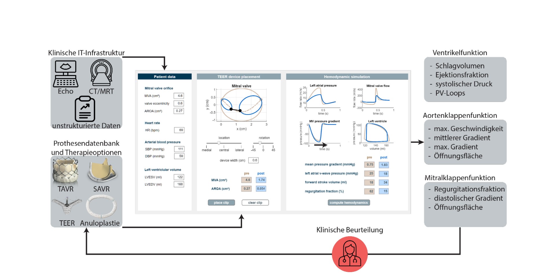 Das Diagramm zeigt die klinische Infrastruktur und Datenanalyse zur Bewertung von Herzfunktionen. Es beinhaltet Hauptkomponenten wie Ventricularfunktion, Aortenklappen- und Mitralkappenfunktion sowie deren relevante Parameter. Am unteren Ende wird die klinische Beurteilung visualisiert, die auf diesen Analysen basiert.