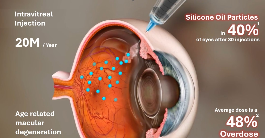 Illustration eines menschlichen Auges mit einer Darstellung einer intravitrealen Injektion. Die Injektion begleitet von blauen Punkten, die möglicherweise die verteilen Wirkstoffe darstellen. Textinformationen erwähnen die Häufigkeit dieser Behandlungen und mögliche Risiken, wie Silikonölpartikel und eine durchschnittliche Überdosierung.