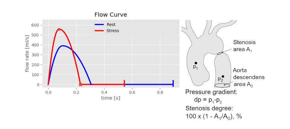 Die Abbildung zeigt eine Flusskurve mit zwei Linien: blau für Ruhe und rot für Stress, die den Fluss über die Zeit darstellen. Rechts sind anatomische Diagramme mit Druckpunkten und einer Stenose beschrieben. Die Formeln erläutern den Druckgradienten und den Grad der Stenose.